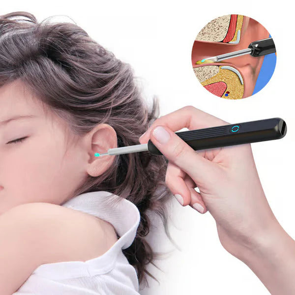 Earwax Removal Kit مجموعة إزالة شمع الأذن