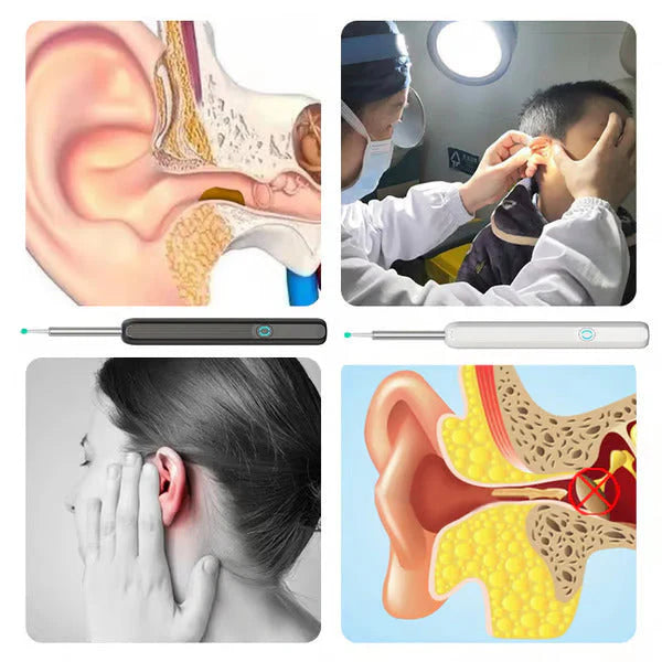 Earwax Removal Kit مجموعة إزالة شمع الأذن